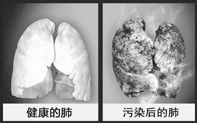 被霧霾感染的肺 被霧霾感染的肺